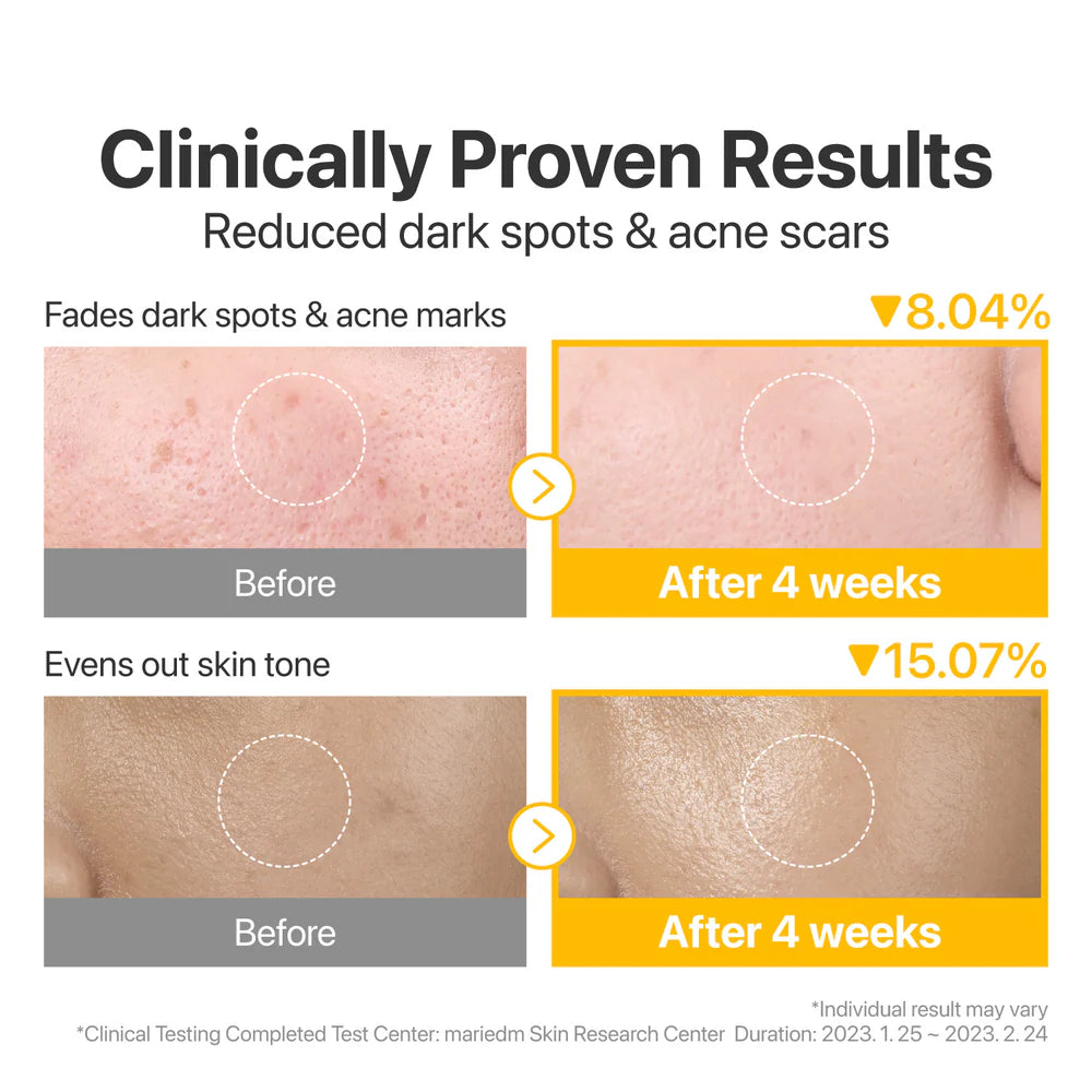 NUMBUZIN N°5+ Tampon concentré de vitamine-niacinamide 70 tampons