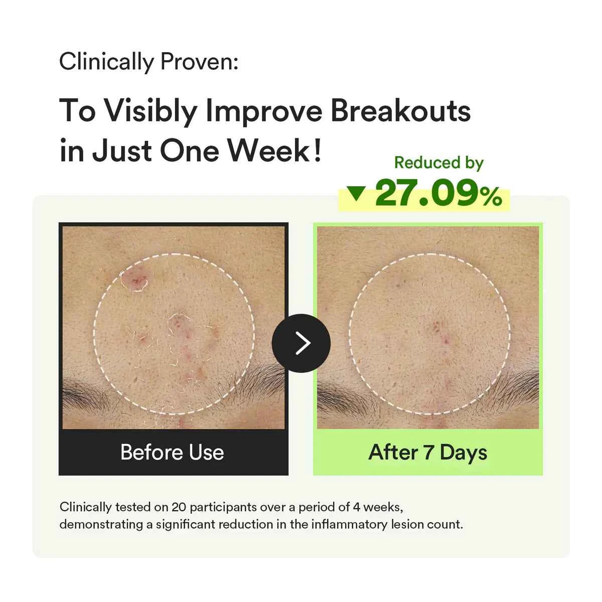 ABIB Heartleaf TECA Capsule Serum Calming Drop 50ml