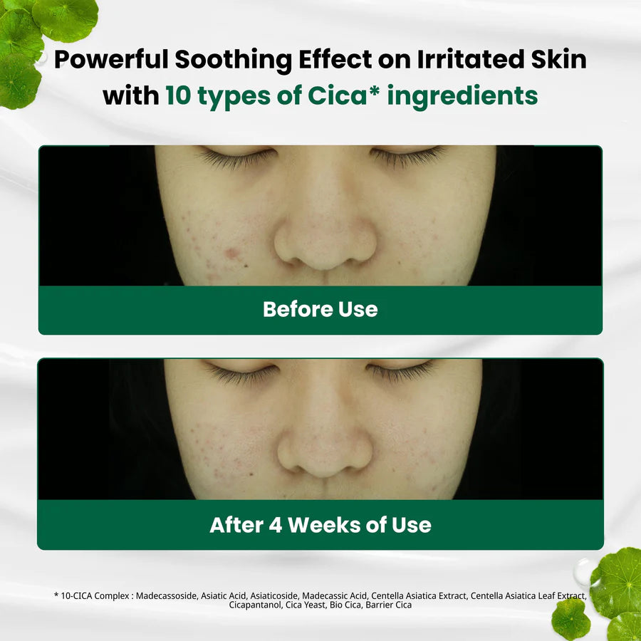 DR.G CRÈME APAISANTE ANTI-IMPERfections Rouges 70 ml