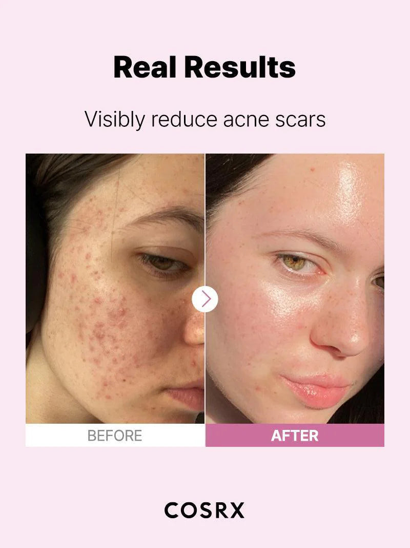 COSRX Le Sérum Niacinamide 15 20 ml